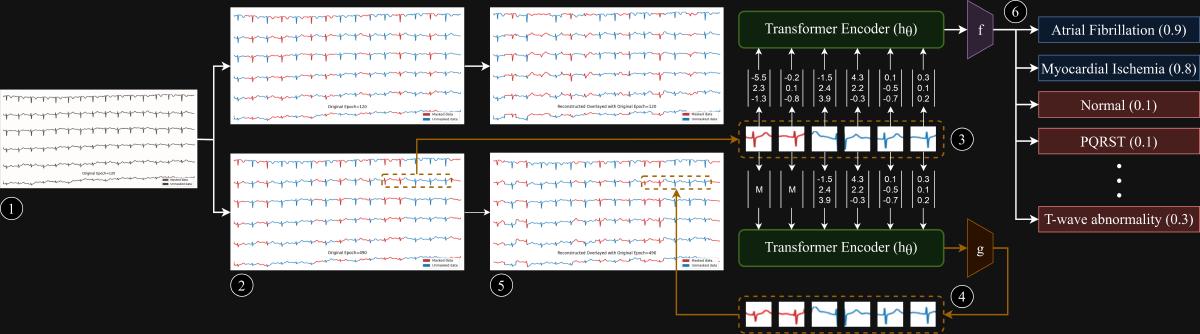 PatchECG: Self-Supervised ECG Arrhythmia Detection
